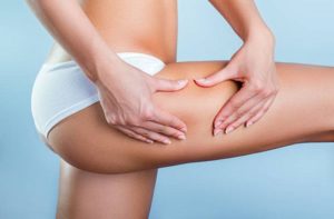acqua e cellulite
